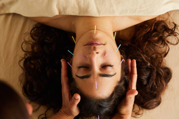 High angle of a woman lying on a table in an alternative medicine spa having an acupuncture and reiki treatment done on her face by an acupucturist
